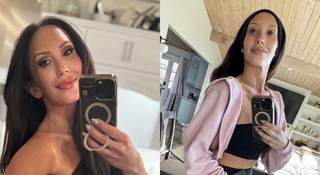 Cheryl Burke gets candid about plastic surgery